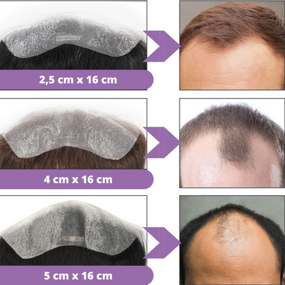 Complément capillaire frontal Homme  - Chatain 2 100% cheveux naturels